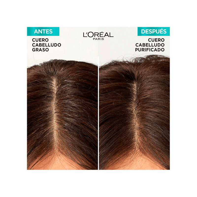 Elvive-Shampoo-Elvive-Hialuronico-Pure-x-200-ml-7509552876413_img1