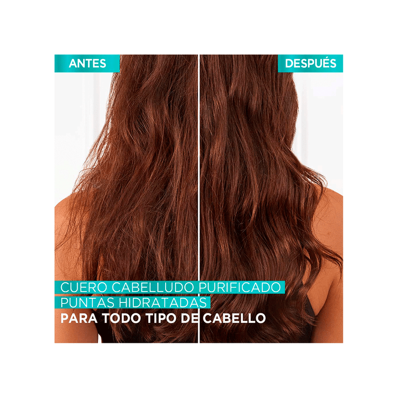 Elvive-Shampoo-Elvive-Hidra-Hialuronico-Pure-x-400-ml-7509552876444_img1
