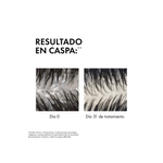 2096307_Vichy-Dercos-Shampoo-Caspa-Cuero-Cabelludo-Sensible-x-200-ml_img1