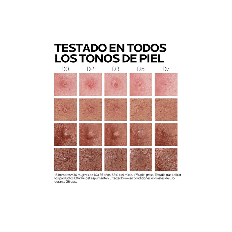 Effaclar-Duo--M-La-Roche-Posay-Corrector-Anti-Marcas-e-Imper-La-Roche-Posay