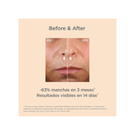 Serum-Isdinceutics-Refill-Melaclear-Advanced-x-30-ml-Isdin